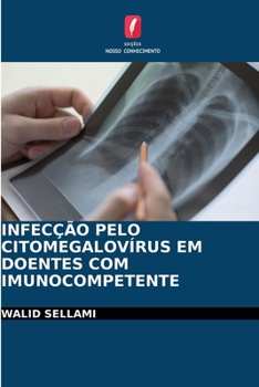 Paperback Infecção Pelo Citomegalovírus Em Doentes Com Imunocompetente [Portuguese] Book