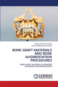 Paperback Bone Graft Materials and Bone Augmentation Procedures Book