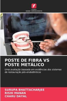 Poste de Fibra Vs Poste Metálico (Portuguese Edition)