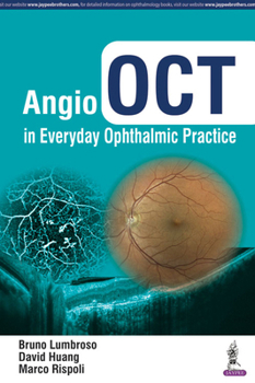 Angio Oct in Everyday Ophthalmic Practice