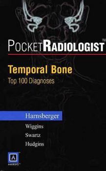 Paperback Pocketradiologist - Temporal Bone: Top 100 Diagnoses Book