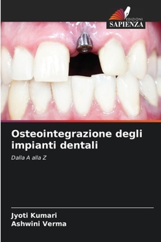 Paperback Osteointegrazione degli impianti dentali [Italian] Book