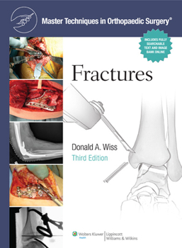 Paperback Master Techniques in Orthopaedic Surgery: Fractures Book