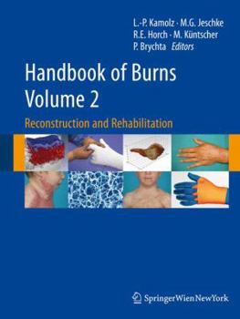 Hardcover Handbook of Burns, Volume 2: Reconstruction and Rehabilitation Book