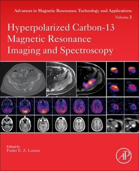 Paperback Hyperpolarized Carbon-13 Magnetic Resonance Imaging and Spectroscopy: Volume 3 Book