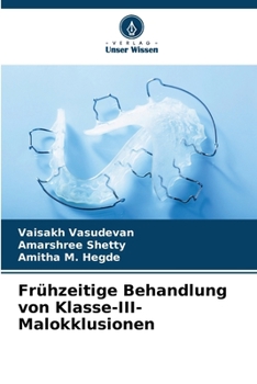 Paperback Frühzeitige Behandlung von Klasse-III-Malokklusionen [German] Book