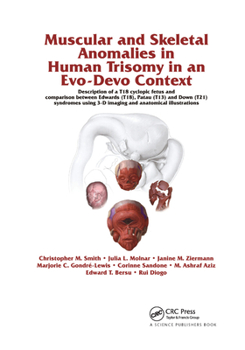 Paperback Muscular and Skeletal Anomalies in Human Trisomy in an Evo-Devo Context: Description of a T18 Cyclopic Fetus and Comparison Between Edwards (T18), Pat Book