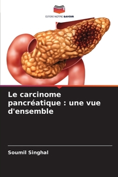 Paperback Le carcinome pancréatique: une vue d'ensemble [French] Book
