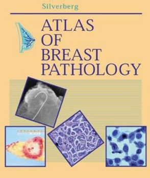 Atlas of Breast Pathology (Atlases in Diagnostic Surgical Pathology)