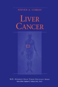 Paperback Liver Cancer Book