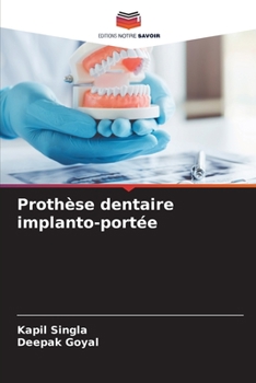 Paperback Prothèse dentaire implanto-portée [French] Book