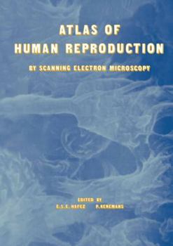 Paperback Atlas of Human Reproduction: By Scanning Electron Microscopy Book