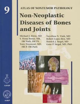 Hardcover Non-Neoplastic Diseases of Bones and Joints Book