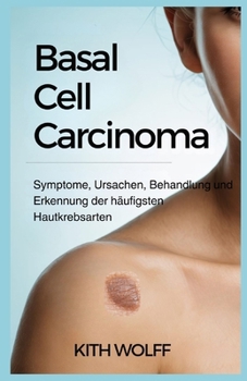 Basal Cell Carcinoma: Symptome, Ursachen, Behandlung und Erkennung der häufigsten Hautkrebsarten (German Edition)