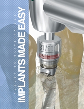 Paperback Implants Made Easy Book