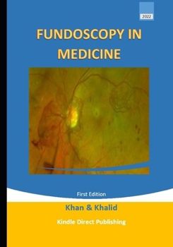 Paperback Fundoscopy in Medicine Book