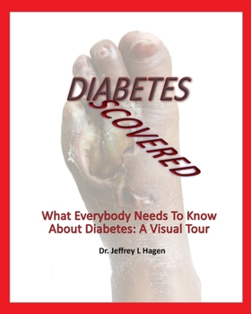 Paperback Diabetes Discovered: What Everybody Needs To Know About Diabetes: A Visual Tour [Large Print] Book