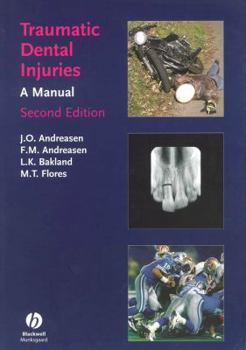 Paperback Traumatic Dental Injuries: A Manual, 2e Book