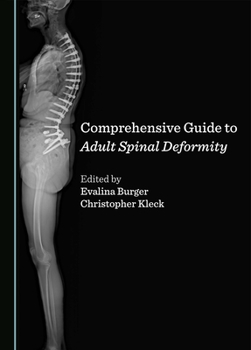 Paperback Comprehensive Guide to Adult Spinal Deformity Book