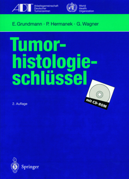 Paperback Tumor-Histologieschlüssel: Empfehlungen Zur Aktuellen Klassifikation Und Kodierung Der Neoplasien Auf Der Grundlage Der ICD-O [German] Book