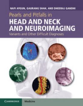 Hardcover Pearls and Pitfalls in Head and Neck and Neuroimaging: Variants and Other Difficult Diagnoses Book
