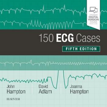 Paperback 150 ECG Cases Book