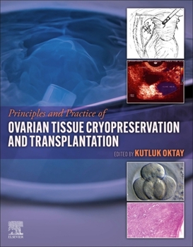 Hardcover Principles and Practice of Ovarian Tissue Cryopreservation and Transplantation Book