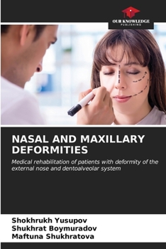 Paperback Nasal and Maxillary Deformities Book