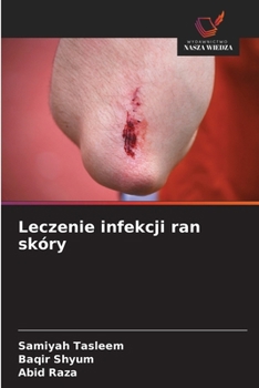 Paperback Leczenie infekcji ran skóry [Polish] Book