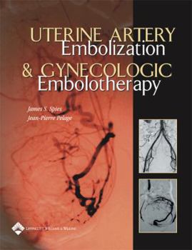 Hardcover Uterine Artery Embolization And Gynecologic Embolotherapy Book
