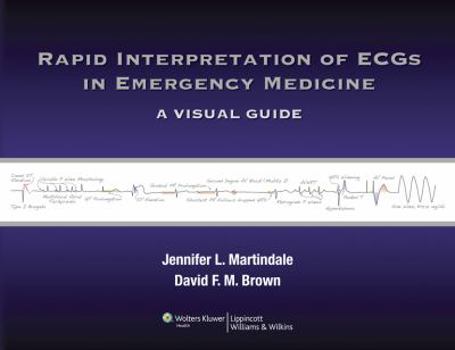 Paperback Rapid Interpretation of ECGs in Emergency Medicine: A Visual Guide Book