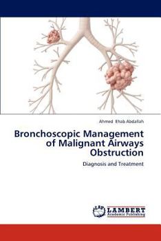 Paperback Bronchoscopic Management of Malignant Airways Obstruction Book
