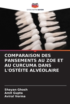 Paperback Comparaison Des Pansements Au Zoe Et Au Curcuma Dans l'Ostéite Alvéolaire [French] Book