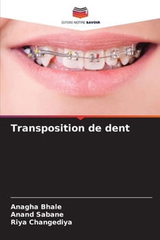 Paperback Transposition de dent [French] Book
