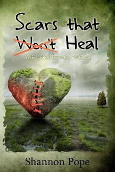 Paperback Scars That Heal: A life healed from the inside out Book