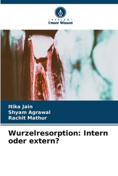 Paperback Wurzelresorption: Intern oder extern? [German] Book