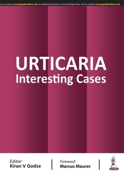 Paperback URTICARIA INTERESTING CASEs Book
