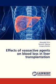 Paperback Effects of Vasoactive Agents on Blood Loss in Liver Transplantation Book