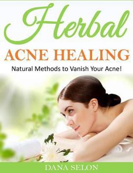 Paperback Herbal Acne Healing: Natural Methods to Vanish Your Acne! Book