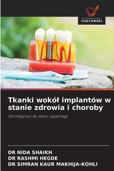 Tkanki wokól implantów w stanie zdrowia i choroby (Polish Edition)