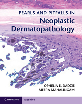 Hardcover Pearls and Pitfalls in Neoplastic Dermatopathology with Online Access Book