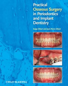 Hardcover Practical Osseous Surgery in Periodontics and Implant Dentistry Book