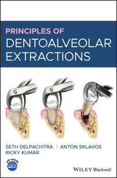 Hardcover Principles of Dentoalveolar Extractions Book