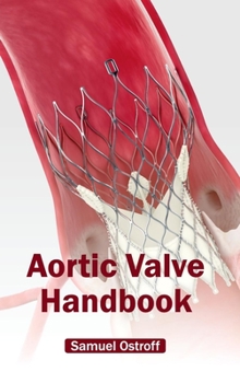 Hardcover Aortic Valve Handbook Book
