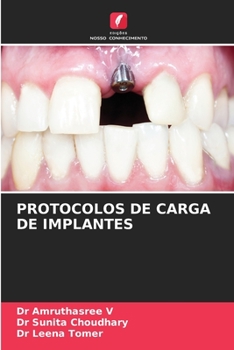 Paperback Protocolos de Carga de Implantes [Portuguese] Book