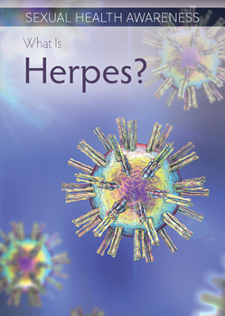 Library Binding What Is Herpes? Book