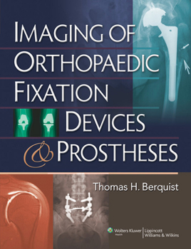 Hardcover Imaging of Orthopaedic Fixation Devices and Prostheses Book