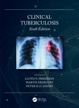 Tuberculosis: Current Concepts and Treatment, Second Edition