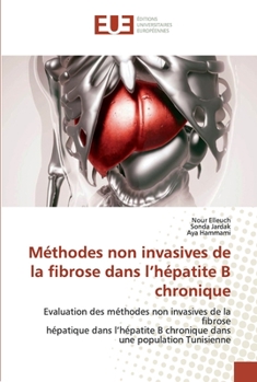 Paperback Méthodes non invasives de la fibrose dans l'hépatite B chronique [French] Book