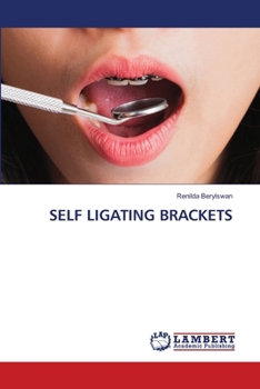 Self Ligating Brackets